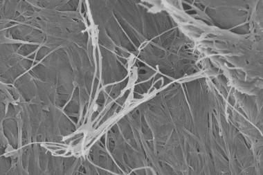 Нановолокна плёнки бактериальной целлюлозы под микроскопом